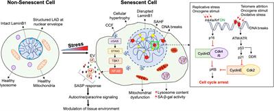 Senescence: a double-edged sword in beta-cell health and failure?